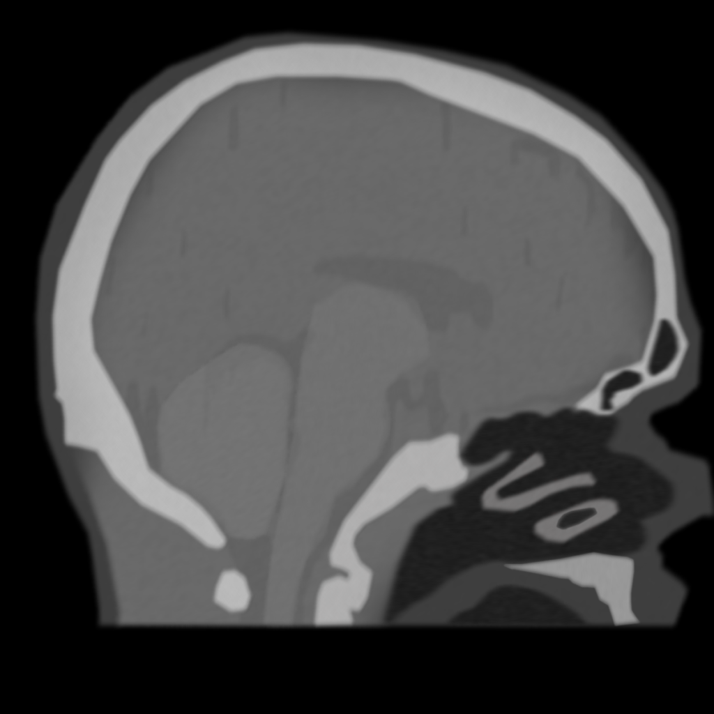 ARD BRAIN CONTOUR